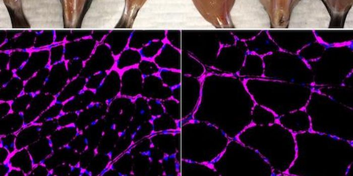 Using CRISPR For Epigenetic Modifications