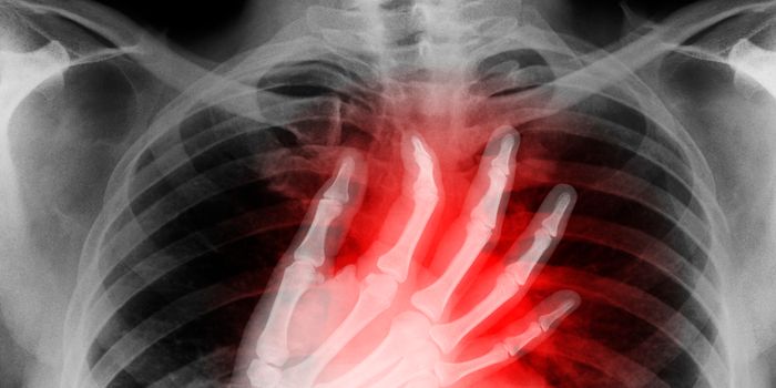 Boosting the Heart's Capacity For Self-Repair Post-Heart Attack