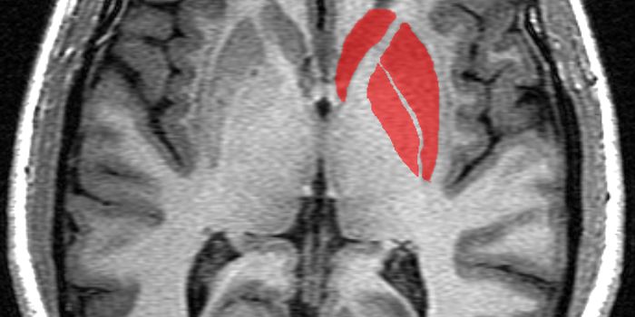 Inflammation Can Cause Fatigue and Depression