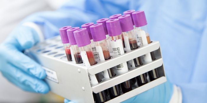 A Faster, Less Invasive Way to Diagnose Rare Diseases in Kids