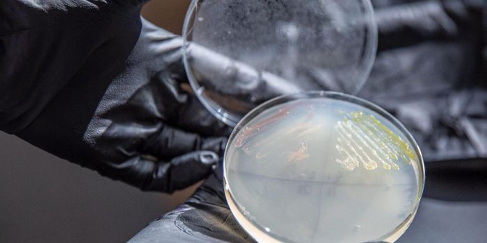 How a Bacterium Can Help Generate Plastic From Plants