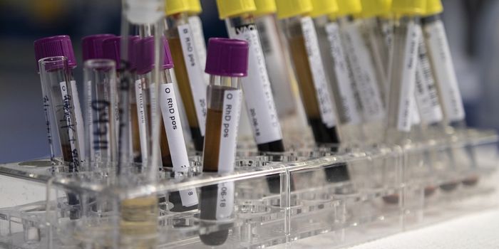 Inexpensive, Fast Detection of Multiple Cancers From One Blood Sample