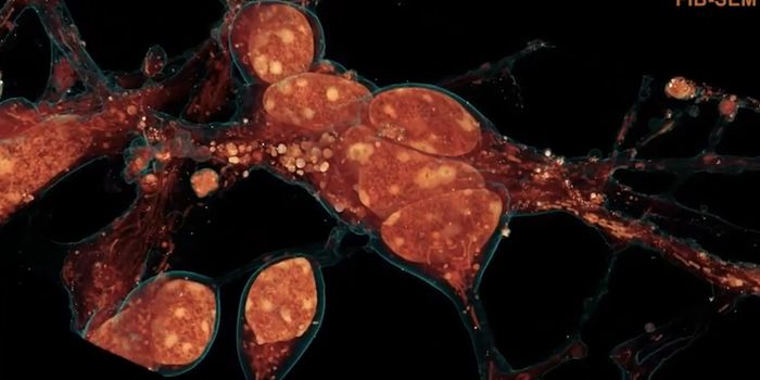 The 3D Ultrastructure of a Cell is Revealed