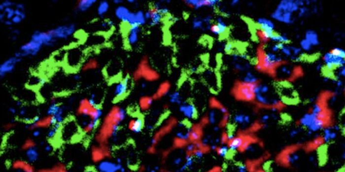 Vitamin D May Aid in Treating Diabetes