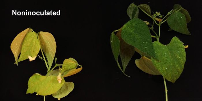 Potential New Antibiotic Discovered in Soil-Dwelling Microbe