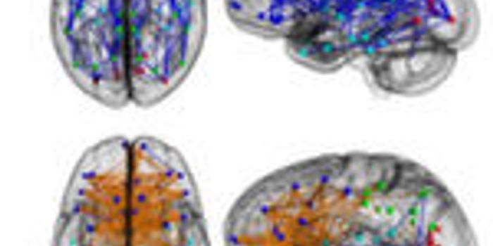 Brain Connectivity Study Reveals Striking Differences Between Men and Women