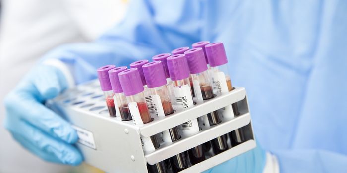 Multicancer Screening Could Notably Decrease Late-Stage Cancer Diagnoses