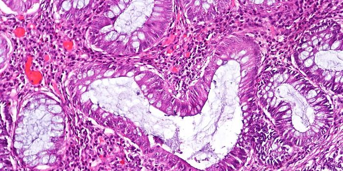 How does estrogen increase the risk of autoimmunity for women?