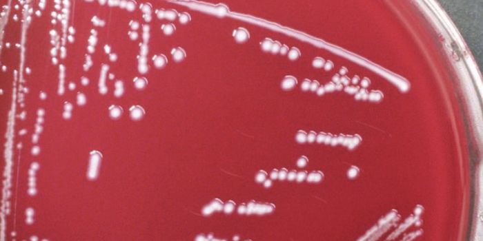 Deadly Microbe Linked to Childhood Brain Disorder