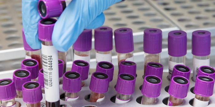 A Simple Vitamin B3 Treatment Could Relieve a Rare Disease