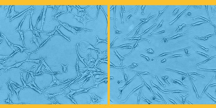 Molecular Gene Switches Linked to Autoimmune Disease