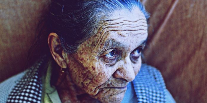 Chronic Inflammation Lowers Levels of Aging-Linked Molecule