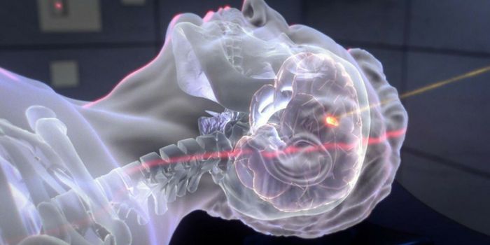 Imagine Your Head, In a Particle Accelerator