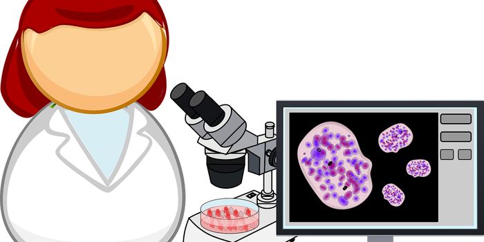 New Therapy Starves Pancreatic Cancer Cells of an Important Amino Acid