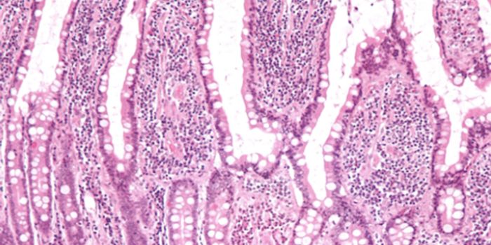 Can Lining Chemical may be Disrupting Intestinal Function