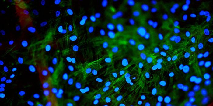 New Technique for Altering Protein Levels in Cells