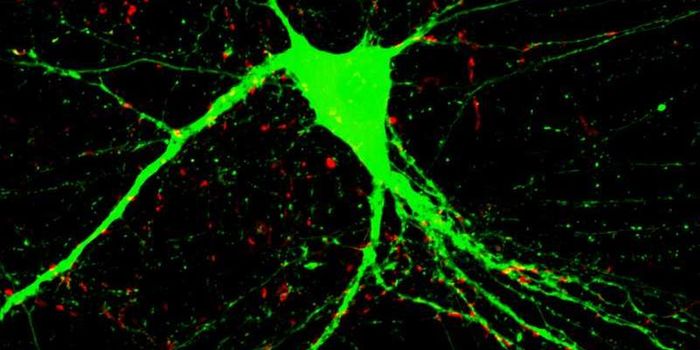 Two Genes Could Help with Treatment of Schizophrenia