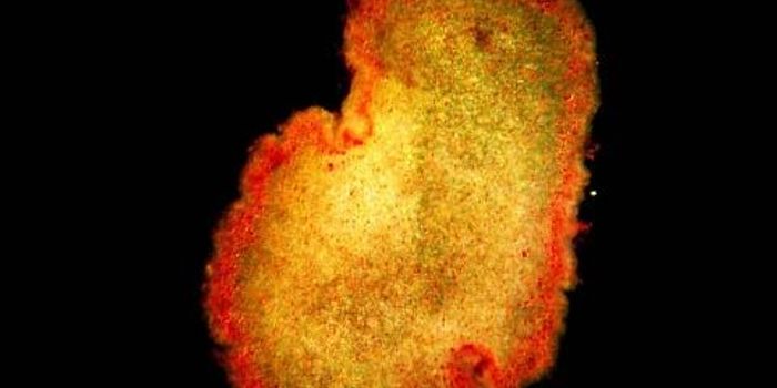 How One of the Simplest Animals Precisely Folds Itself