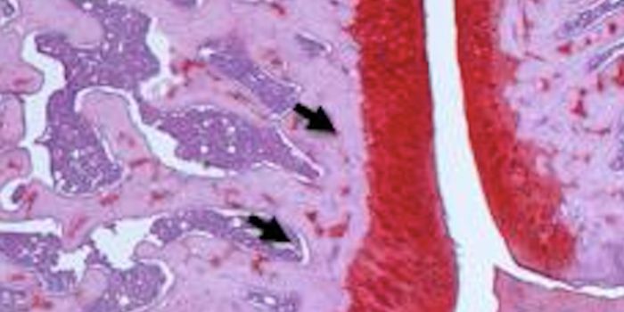 New Molecule is a Potential Arthritis Therapeutic