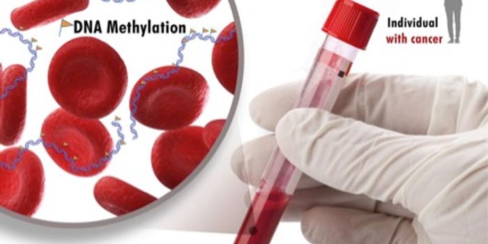 New DNA Hypermethylation Signature Found in 5 Types of Cancers