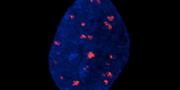 Super-Resolution Microscopy Reveals How DNA Damage is Repaired