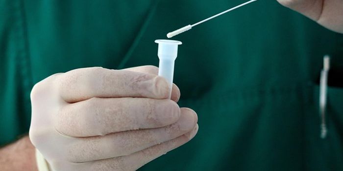 Covid Leads to Accelerated Blood Vessel Aging