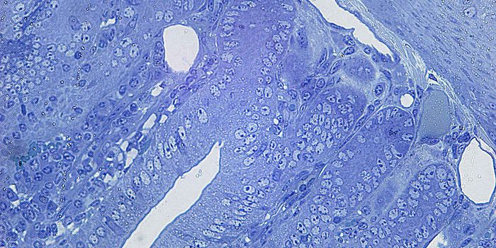 Pathogenic Microbes Manipulate Intestinal Repair for Their Needs