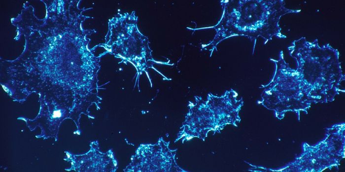 How Scientists 'Carbon Dated' Colorectal Cancer