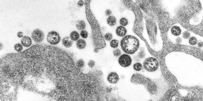 Preventing Lethal Shock During Hemorrhagic Fevers