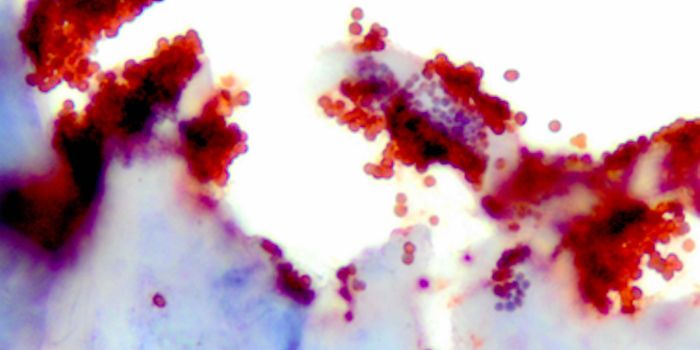 How Stem Cells May Aid in the Treatment of MRSA