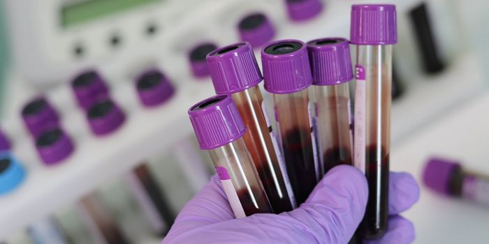 Blood Proteins Could Predict Cancer Many Years Before Diagnosis