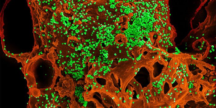 When Humans & Wildlife Interact, Viruses Spill Over