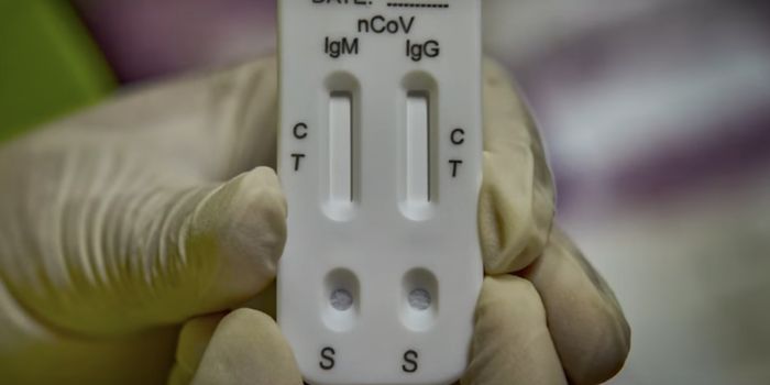 The FDA Yanks Some COVID-19 Antibody Tests From the Market