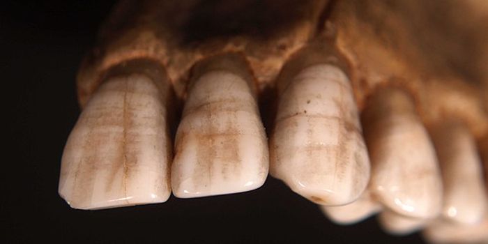 Teeth Record Life's Stressful Events in Primates