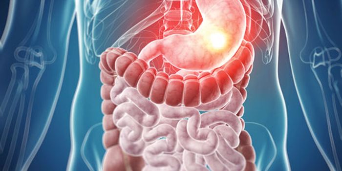 Regulating the Immune Response to Relieve IBD Symptoms