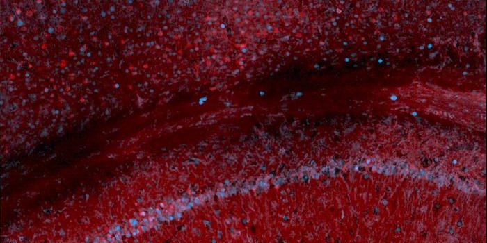 A New Tool Tracks Gene Activity in the Brain with a Blood Sample
