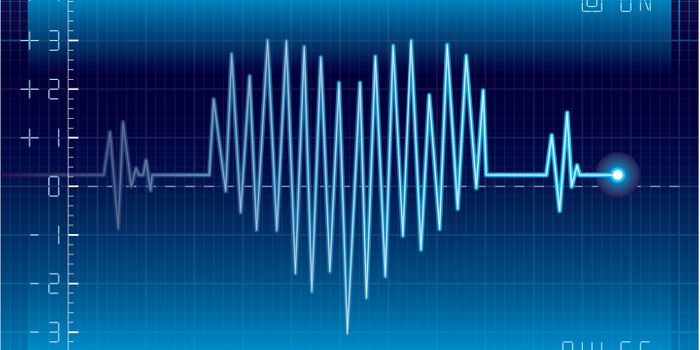 Myotonic Dystrophy-Related Heart Arrhythmia Explained