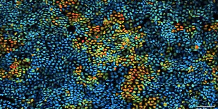 Signaling Waves Help Guide Cells to Heal Wounds