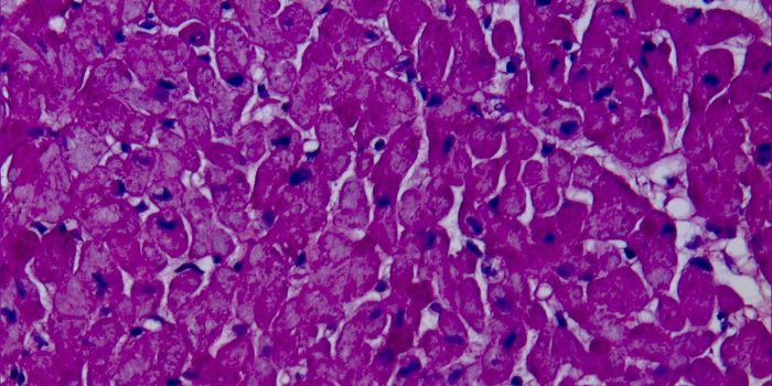 Understanding Heart Disease at the Microscopic Level