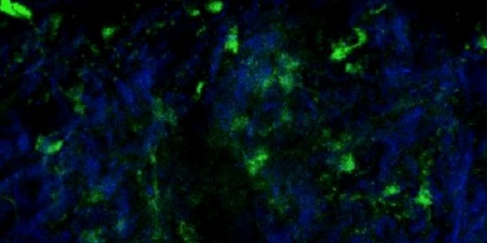 Nitric Oxide Treats Heart Attack, Asthma, and Impotence