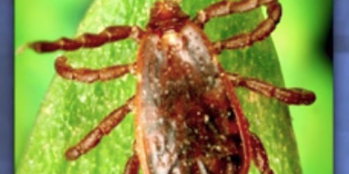 What is Rocky Mountain Spotted Fever?