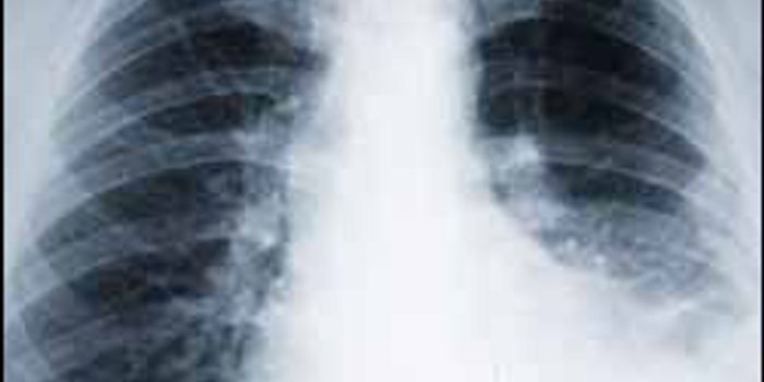 Israeli Device Measures Foreign Matter in Lungs