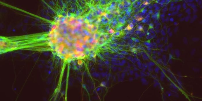 Learning More About the Causes of Endometriosis Pain