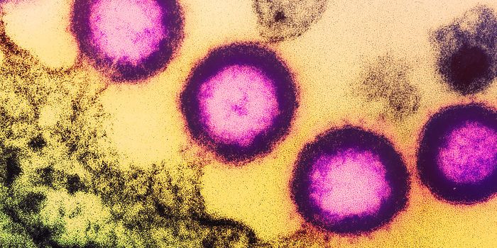 HIV Vaccine Candidate Triggers Production of Crucial, Neutralizing Antibodies