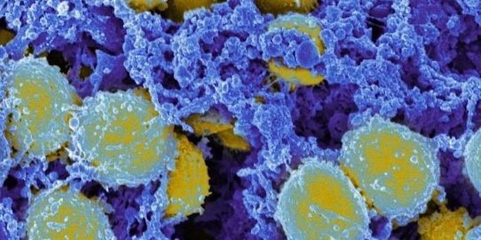 Vaccine Aimed at Fungi May Also Protect Against MRSA