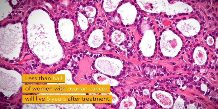 The Details of Ovarian Tumors