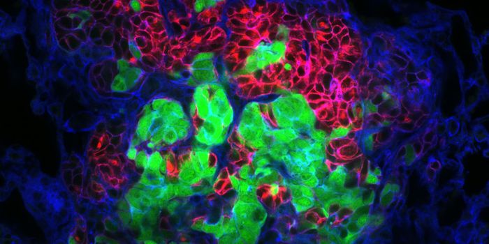 Cancer cells travel in packs to survive and spread