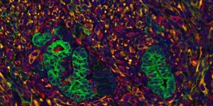 The Cues that Tell Pancreatic Cancer to Steal