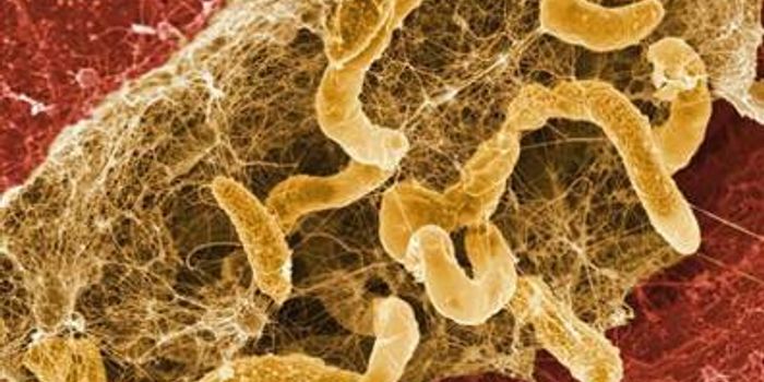 Do Biofilms Spur Autoimmunity?