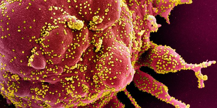 SARS-CoV-2 Makes Cells Sprout Infectious Tentacles